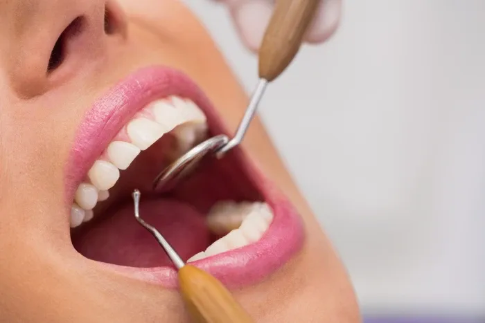 Differences between aesthetic filling and traditional filling.webp