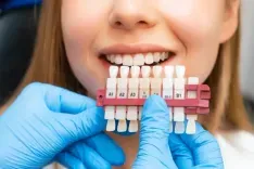 Is Laminate Tooth Durable